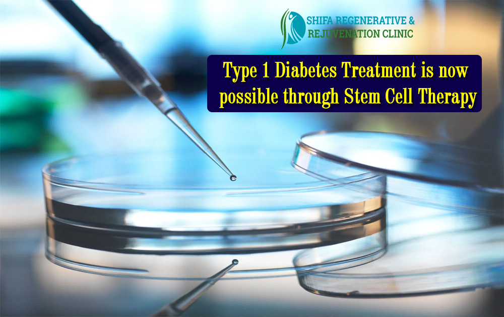 Type 1 Diabetes Treatment is now possible through Stem Cell Therapy