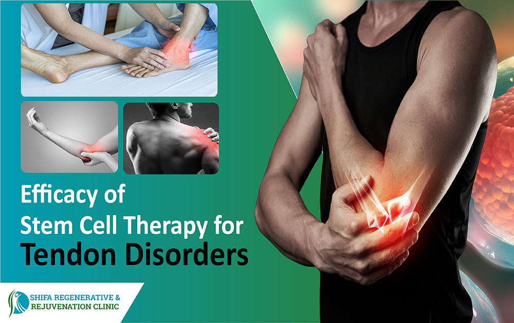Efficacy of Stem Cell Therapy for Tendon Disorders - Shifa Regenerative & Rejuvenation Clinic