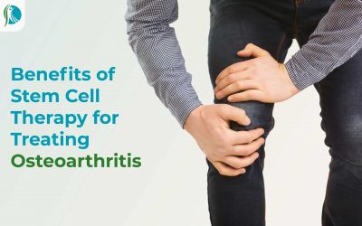 Benefits of Stem Cell Therapy for Treating Osteoarthritis