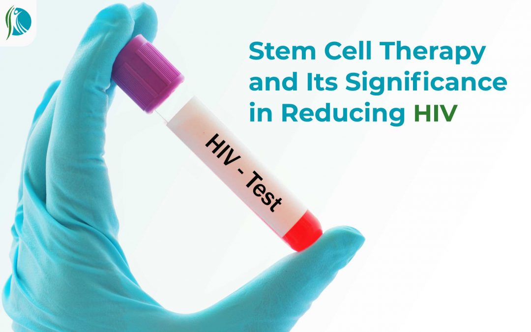Stem Cell Therapy for HIV (Aids)