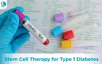 Stem Cell Therapy for Type 1 Diabetes