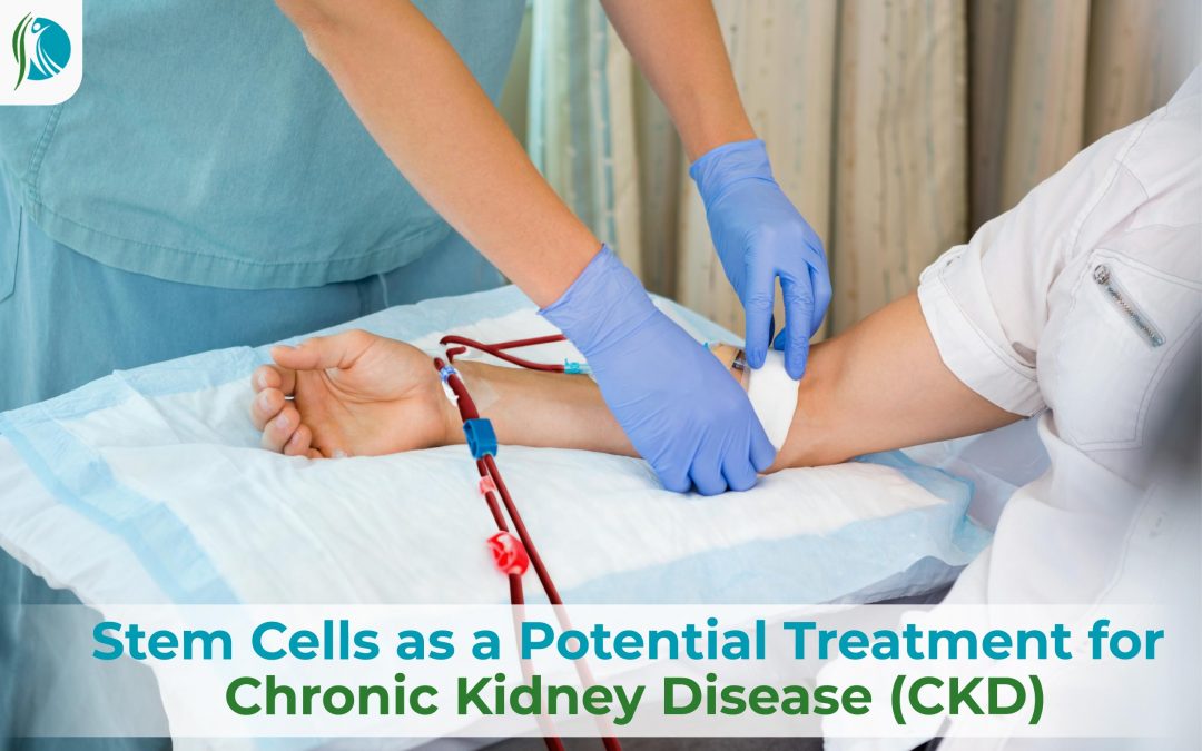 Stem Cells as a Potential Treatment for Chronic Kidney Disease (CKD)
