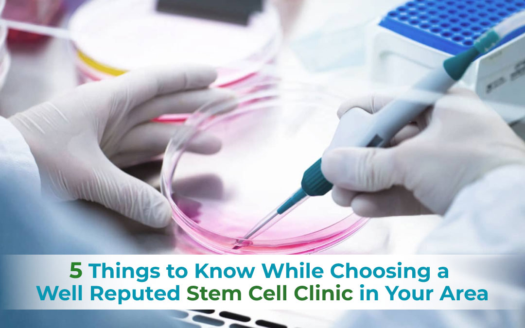 5 Things to Know While Choosing a Well Reputed Stem Cell Clinic in Your Area